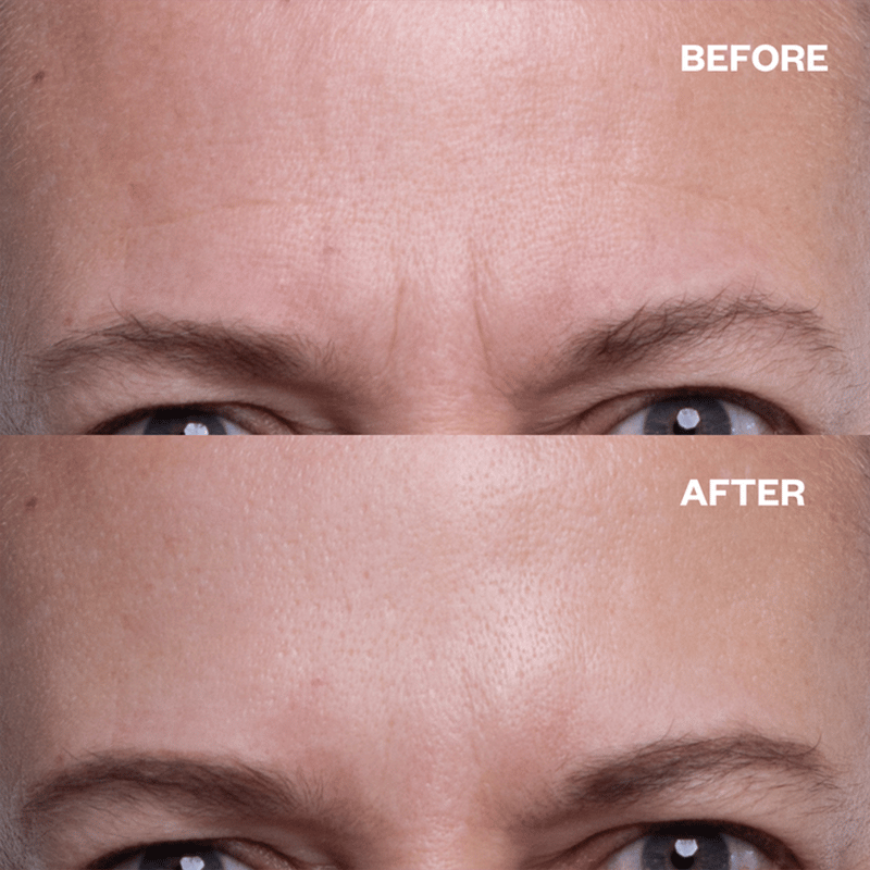SmoothSilk™ - Rimpelloos in je slaap!