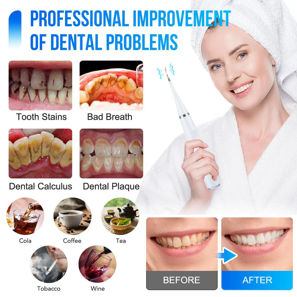 ToothCleaner™ - Effectieve verzorging voor uw tanden!