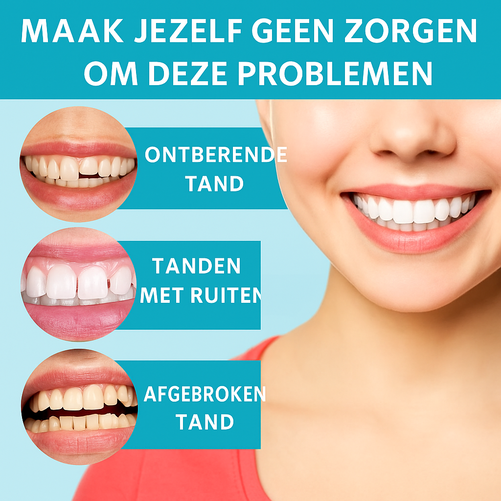 Snap-On™ - Altijd een perfecte glimlach met deze Facings