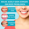 Snap-On™ - Altijd een perfecte glimlach met deze Facings