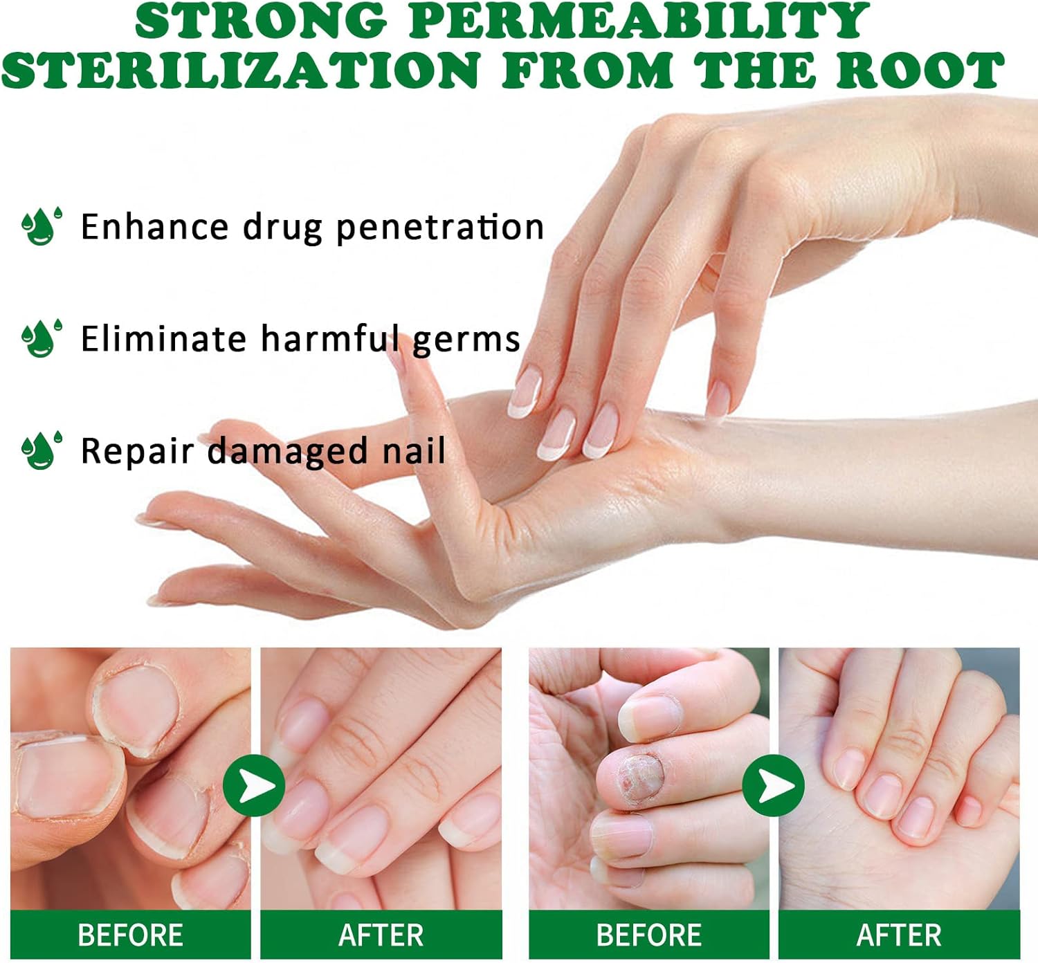 FungiGone™ - Voor gezonde, mooie nagels zonder schimmelinfecties