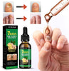 FungiGone™ - Voor gezonde, mooie nagels zonder schimmelinfecties