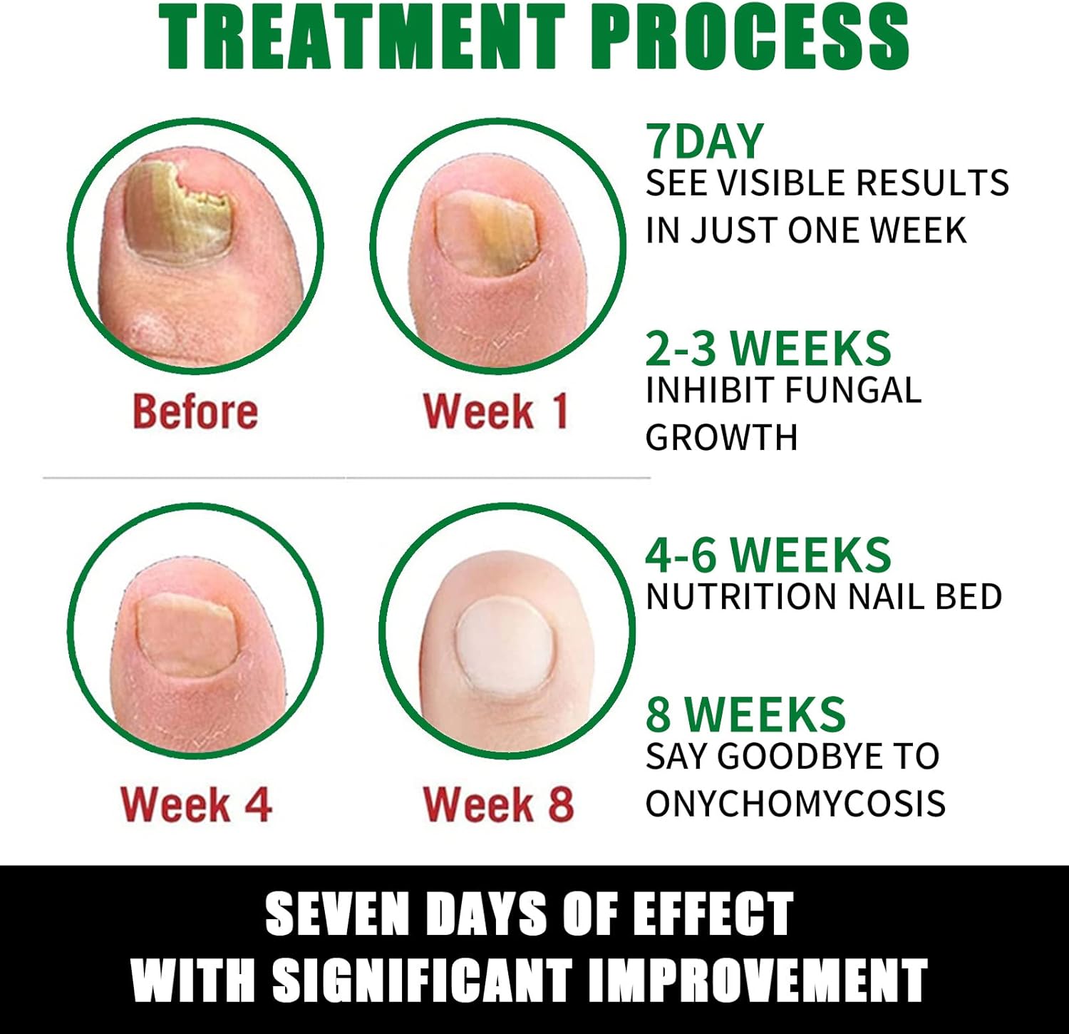 FungiGone™ - Voor gezonde, mooie nagels zonder schimmelinfecties