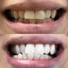 1+1 GRATIS | BrillianceBright™ Precisie penseelpunt