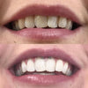 1+1 GRATIS | BrillianceBright™ Precisie penseelpunt