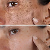 Luminate™ – Glow Serum voor de correctie van donkere vlekken