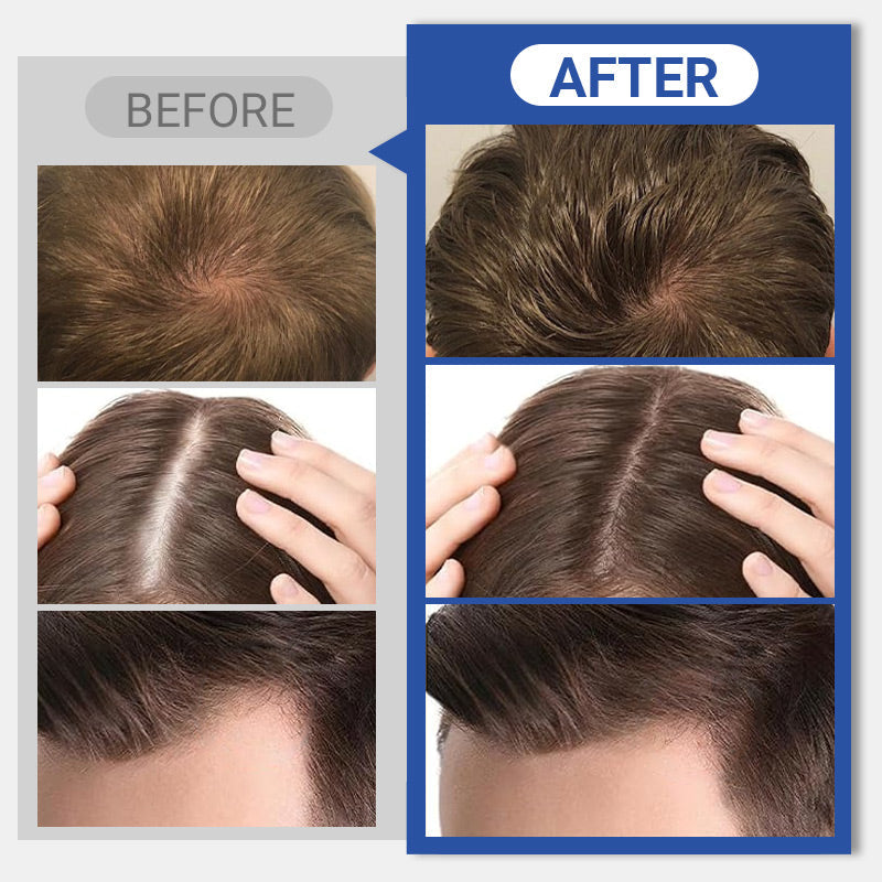 1+1 GRATIS | VoluFiber™ Natuurlijke Volume voor fijn haar!