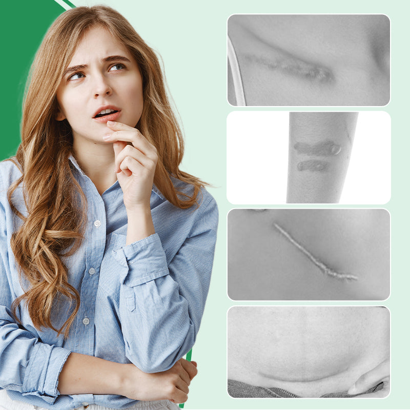 ScarGuard™ – Effectieve Littekenbehandeling