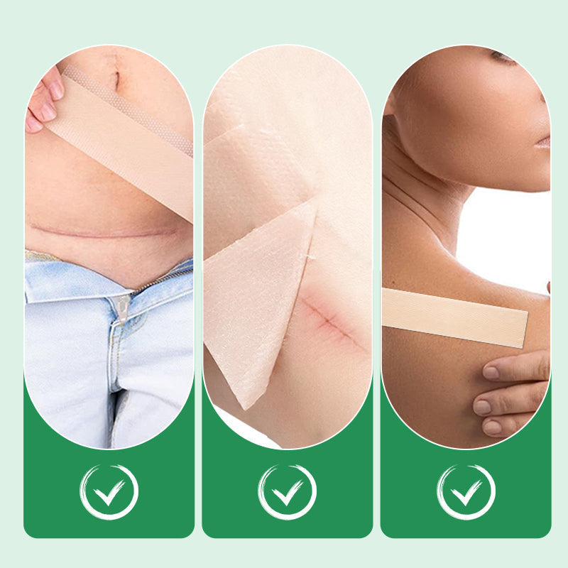 ScarGuard™ – Effectieve Littekenbehandeling